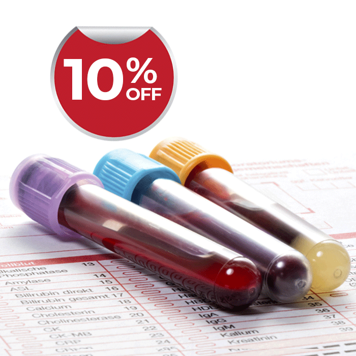 Lab Tests